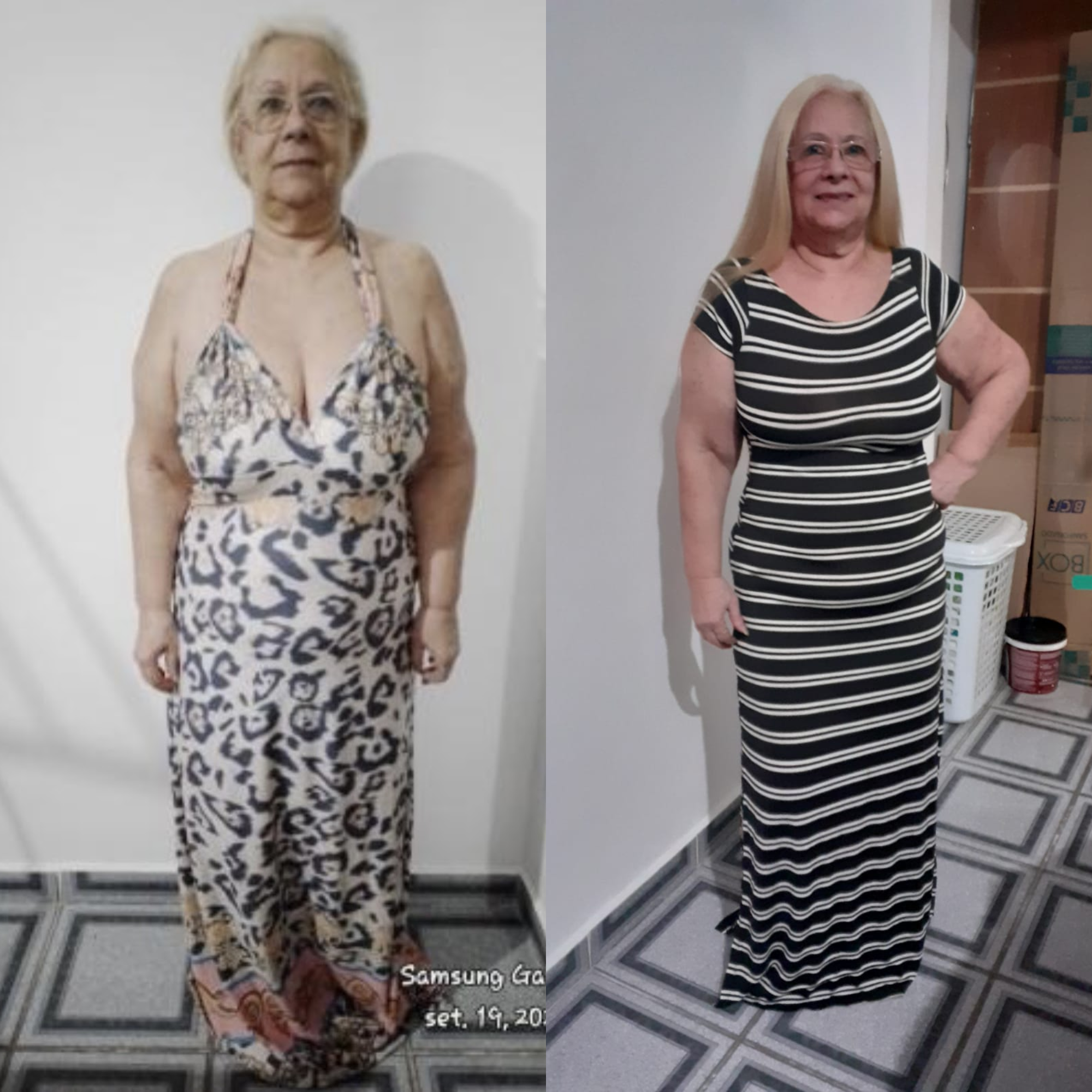Foto de antes e depois de Malu, aluna da mentoria Femme35